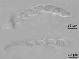 Attēlu rezultāti vaicājumam “Neonectria fuckeliana”