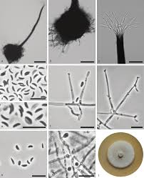 Attēlu rezultāti vaicājumam “Ophiostoma polyporicola”