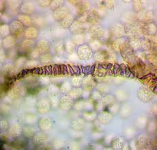 Attēlu rezultāti vaicājumam “Lycogala ustulatum macro”