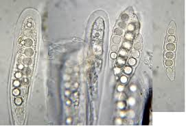 Attēlu rezultāti vaicājumam “Lasiosphaeria ovina spores”