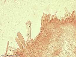 Attēlu rezultāti vaicājumam “Phlebia rufa”