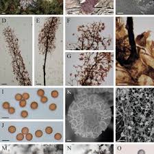Attēlu rezultāti vaicājumam “Amaurochaete atra spores”
