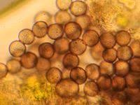 Attēlu rezultāti vaicājumam “Physarum globuliferum spores”