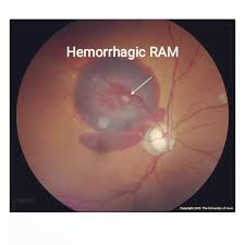 Attēlu rezultāti vaicājumam “Reticularia jurana macro”