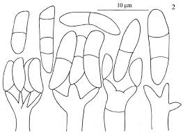 Attēlu rezultāti vaicājumam “Exobasidium splendidum”