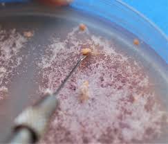 Attēlu rezultāti vaicājumam “Seligeria pusilla sporophyte”