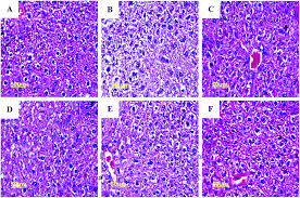 Attēlu rezultāti vaicājumam “Lachnum corticale”