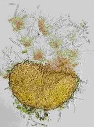 Attēlu rezultāti vaicājumam “Octosporella jungermanniarum”
