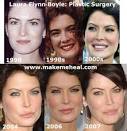laura flynn boyle sex tape
