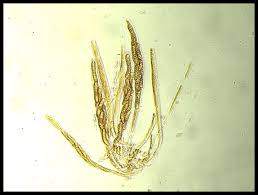 Attēlu rezultāti vaicājumam “Ruzenia spermoides”