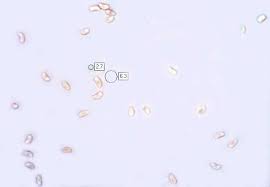 Attēlu rezultāti vaicājumam “Trametes gibbosa”