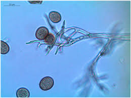 Attēlu rezultāti vaicājumam “Badhamiopsis macrospora spores”