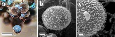 Attēlu rezultāti vaicājumam “Lamproderma ovoideum spores”