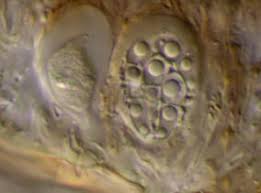 Attēlu rezultāti vaicājumam “Arthonia spadicea”