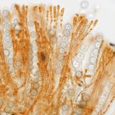 Attēlu rezultāti vaicājumam “Lamprospora tortulae-ruralis”