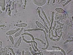 Attēlu rezultāti vaicājumam “Biatora sphaeroides”