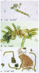 Attēlu rezultāti vaicājumam “Gloeocapsa rupestris”