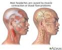 and <b>tension</b>-<b>type headaches</b>