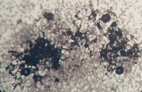 Attēlu rezultāti vaicājumam “Badhamia lilacina spores”