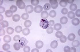 Attēlu rezultāti vaicājumam “Siphoptychium violaceum plasmodium”