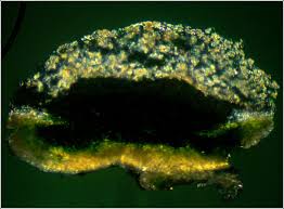 Attēlu rezultāti vaicājumam “Lecanora carpinea”