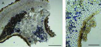 Attēlu rezultāti vaicājumam “Caloplaca saxicola”