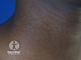 Attēlu rezultāti vaicājumam “Badhamia versicolor”