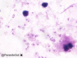 Attēlu rezultāti vaicājumam “Reticularia lobata plasmodium”