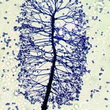 Attēlu rezultāti vaicājumam “Stemonitis marjana macro”