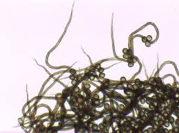 Attēlu rezultāti vaicājumam “Metatrichia sp.”