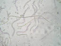 Attēlu rezultāti vaicājumam “Nostoc commune macro”