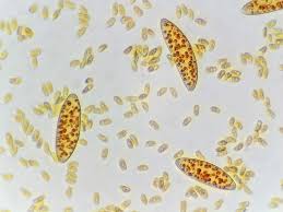 Attēlu rezultāti vaicājumam “Neocudoniella albiceps”