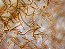 Attēlu rezultāti vaicājumam “Nostoc pruniforme”