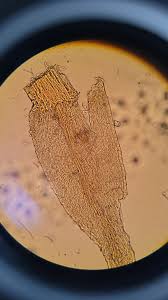 Attēlu rezultāti vaicājumam “Sciuro-hypnum reflexum”