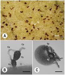 Attēlu rezultāti vaicājumam “Gulielmina vermicularis spores”