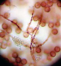 Attēlu rezultāti vaicājumam “Diderma globosum macro”