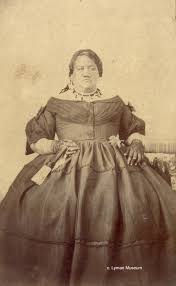 Attēlu rezultāti vaicājumam “Leiocolea rutheana”