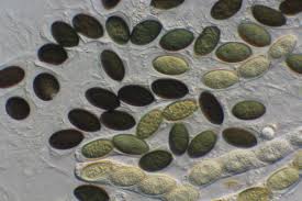 Attēlu rezultāti vaicājumam “Sordaria fimicola”