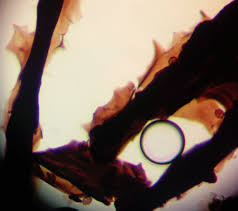 Attēlu rezultāti vaicājumam “Symphytocarpus trechisporus sessile”