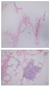 Image result for SYNTHOL