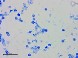 Attēlu rezultāti vaicājumam “Byssocorticium atrovirens”