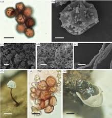 Attēlu rezultāti vaicājumam “Enerthenema papillatum spores”