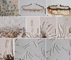 Attēlu rezultāti vaicājumam “Rosellinia desmazieri spores”