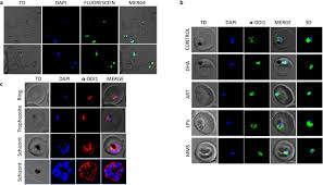 Attēlu rezultāti vaicājumam “Dianema depressum plasmodium”