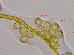 Attēlu rezultāti vaicājumam “Trichia ambigua spores”