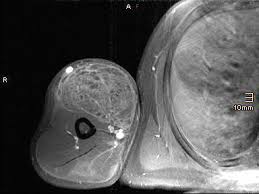 Image result for SYNTHOL