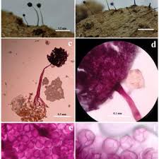 Attēlu rezultāti vaicājumam “Oligonema favogineum spores”