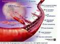 Genetic tests may identify who should get AVASTIN in breast cancer ...