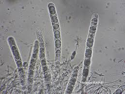 Attēlu rezultāti vaicājumam “Acrocordia gemmata”