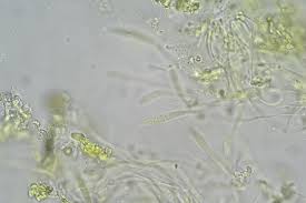 Attēlu rezultāti vaicājumam “Propolis farinosa”